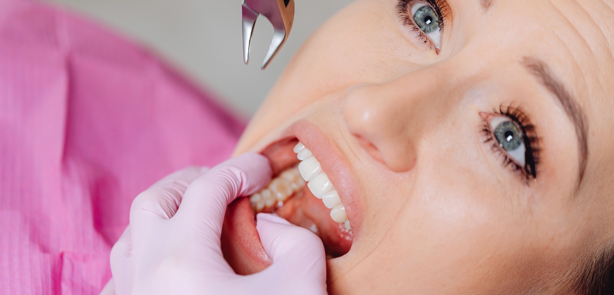 dos and don'ts of wisdom tooth extraction