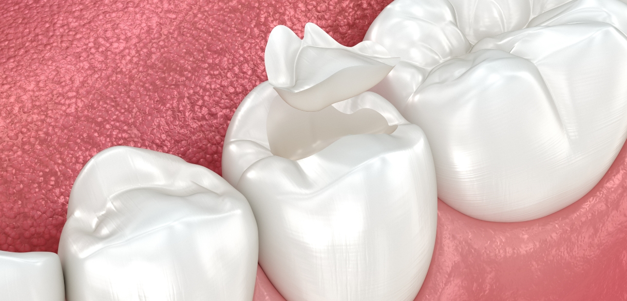 Can You Repair Your Tooth Enamel