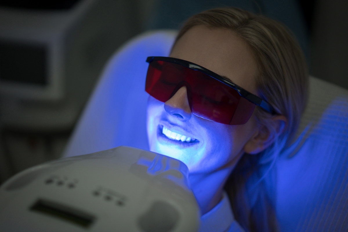 teeth-whitening-in-Spring-Hill