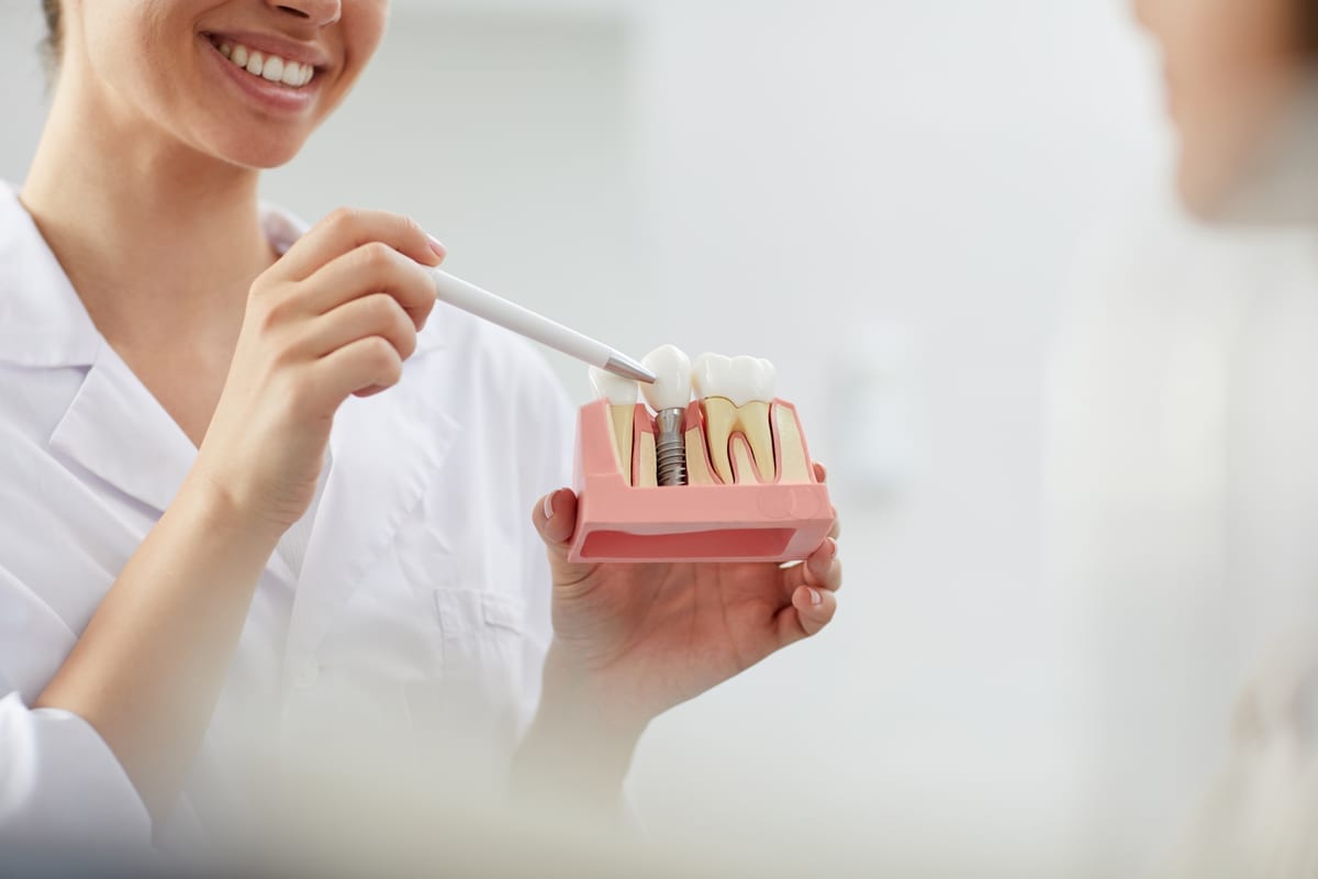 Dental Implants in High Point